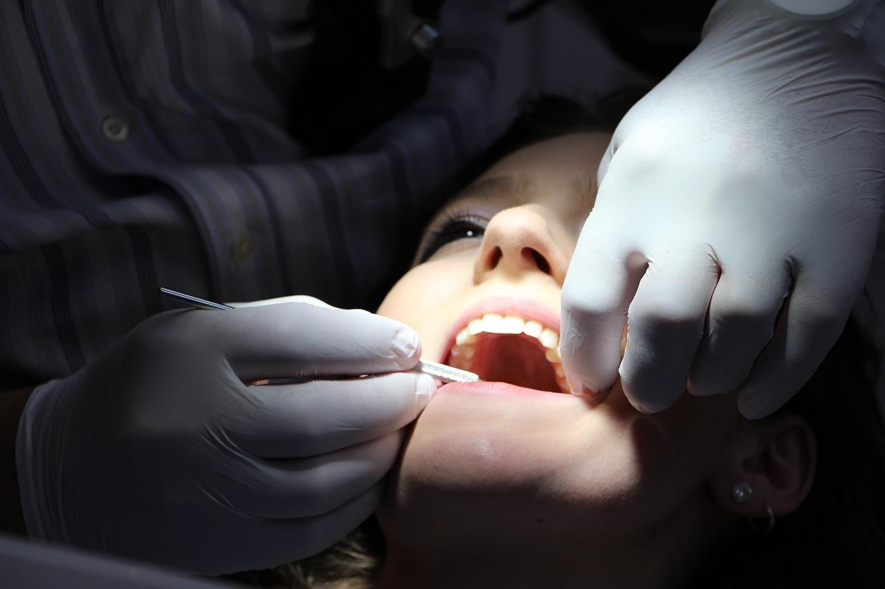 Chirurgiczne usuwanie zębów – na czym to polega?