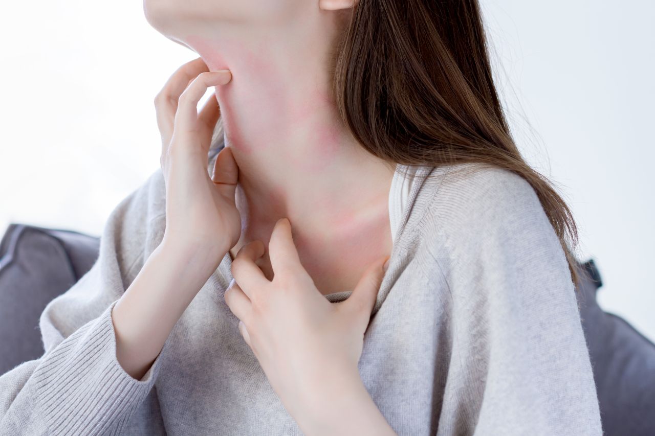 Co najczęściej jest przyczyną alergii skórnych?